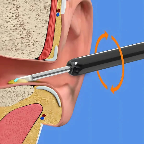 (🔥Last Day Promotion- SAVE 60% OFF)1080P Ear Wax Removal Camera