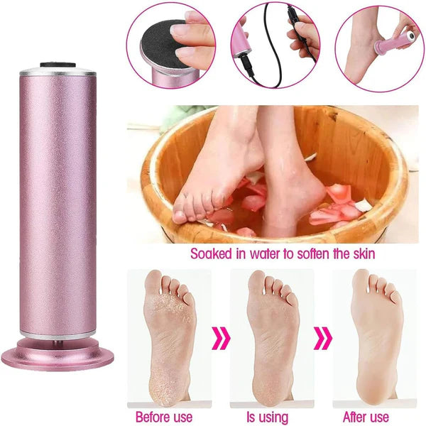 🔥LAST DAY PROMOTION 49% OFF 🔥Electric Foot Callus Remover